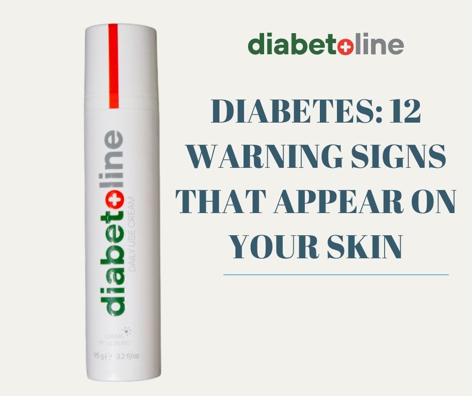 DIABETES: 12 WARNING SIGNS THAT APPEAR ON YOUR SKIN